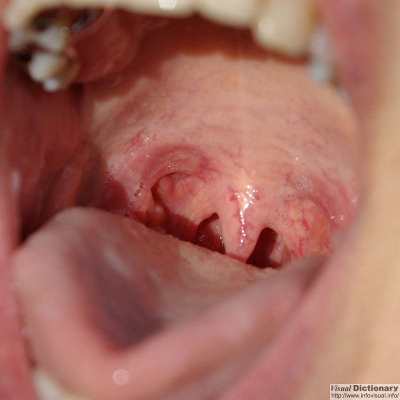 Oral 
          cavity