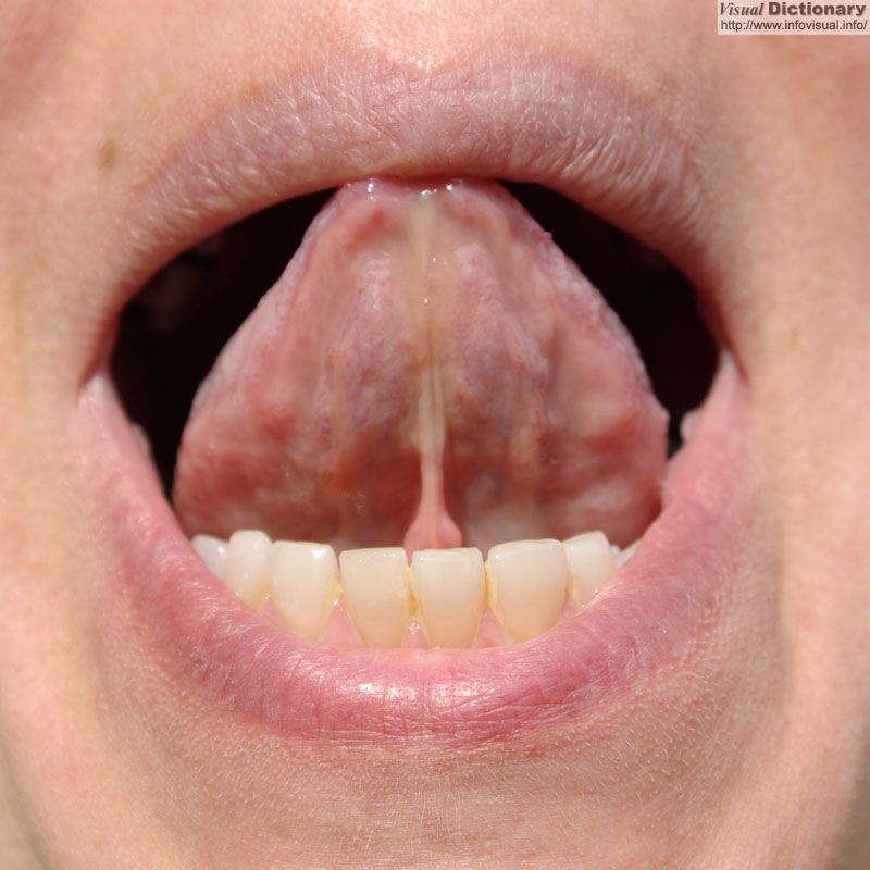 Tongue 
          lower surface